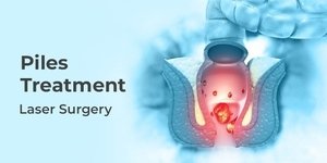 Piles Laser Treatment